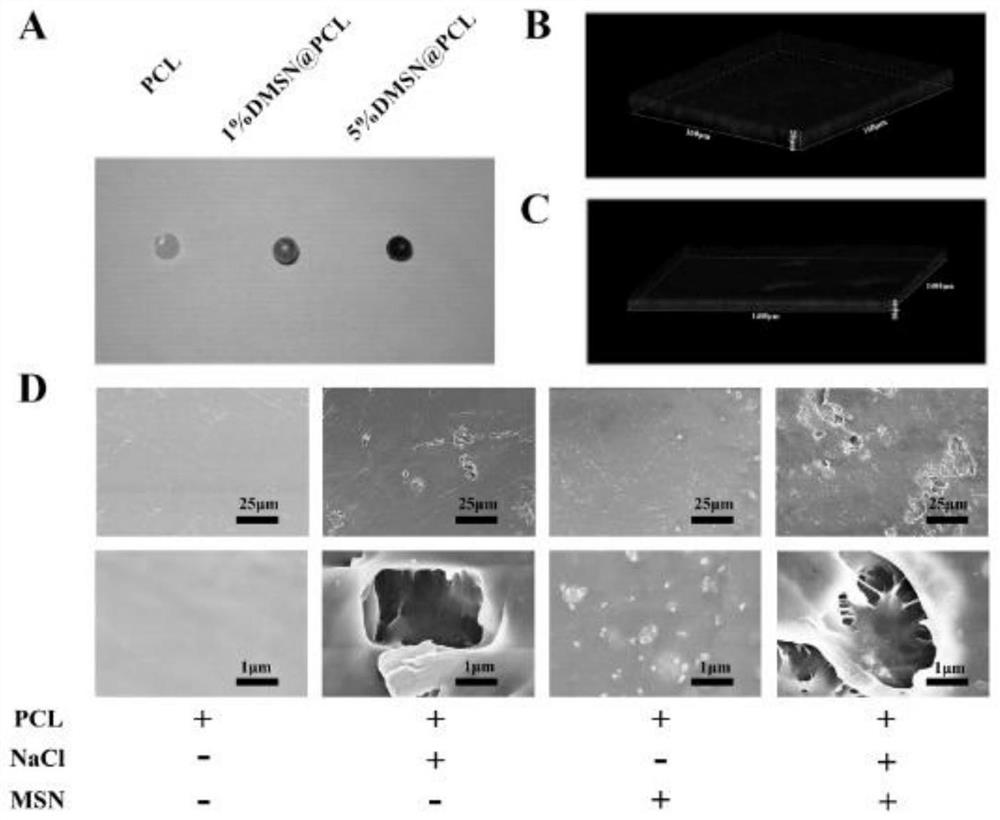 Preparation method and application of a nanocomposite material for inhibiting postoperative tumor recurrence