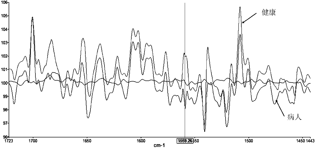 Biological molecule detecting method based on optical comb coherent imaging analysis