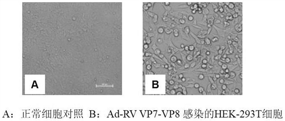 Porcine rotavirus recombinant protein, recombinant adenovirus expressing same protein and application
