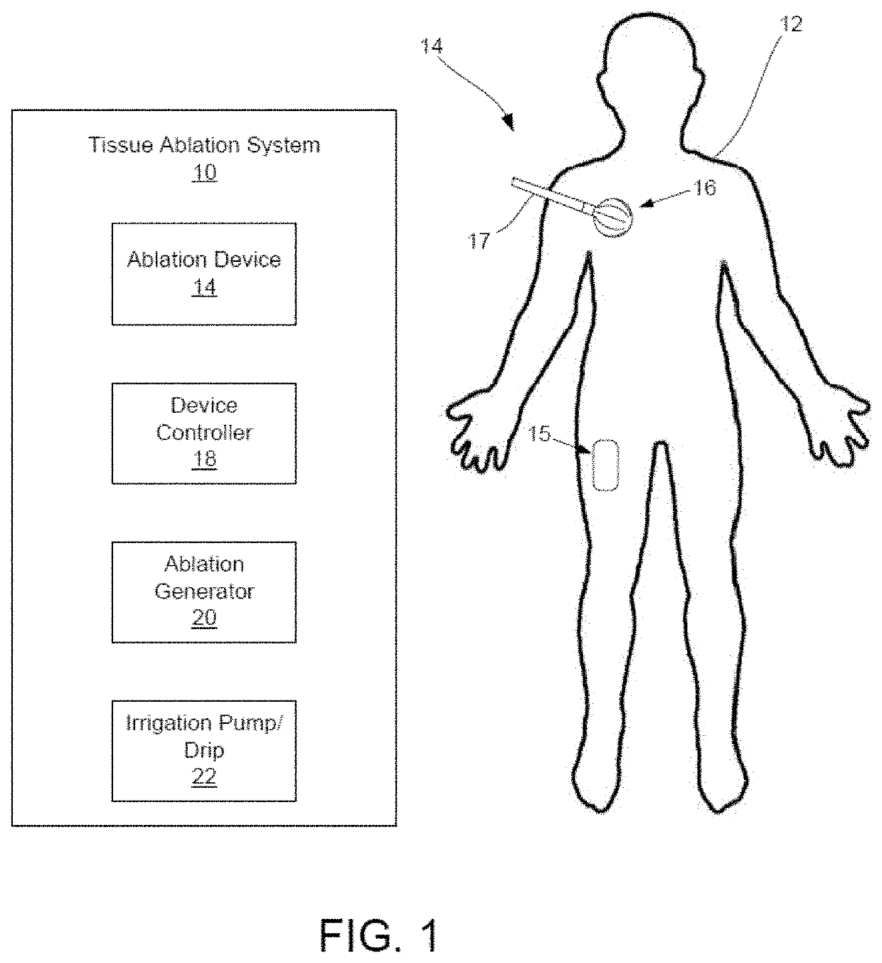 Cavitary tissue ablation