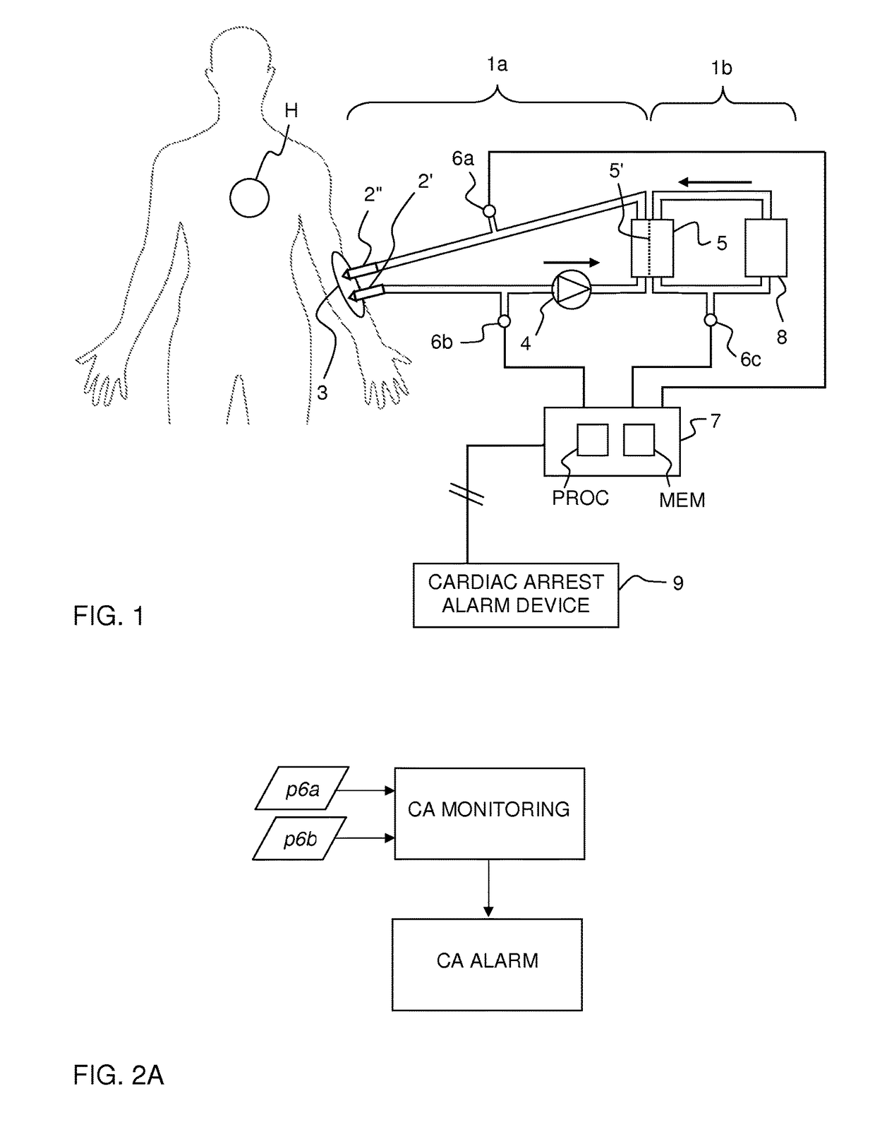 Monitoring of cardiac arrest in a patient connected to an extracorporeal blood processing apparatus