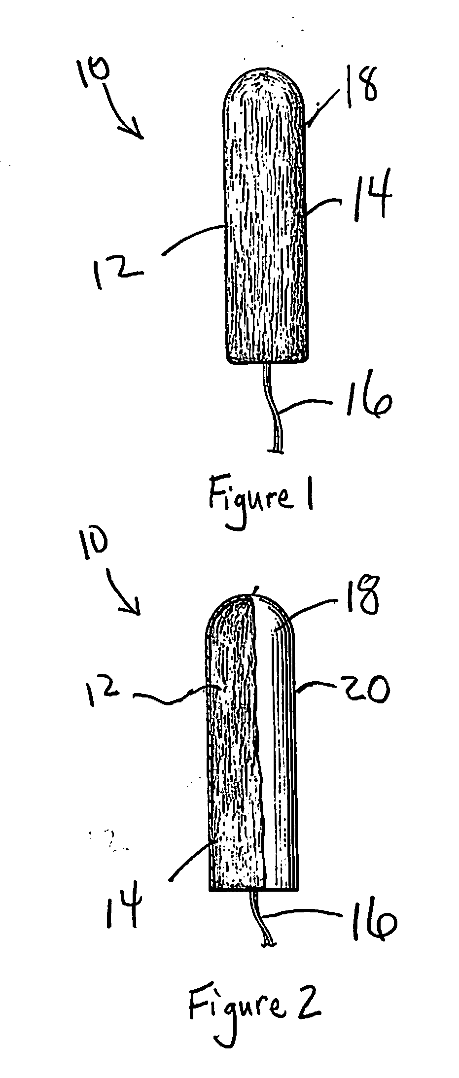 Apparatus and method for the treatment of abnormal uterine bleeding