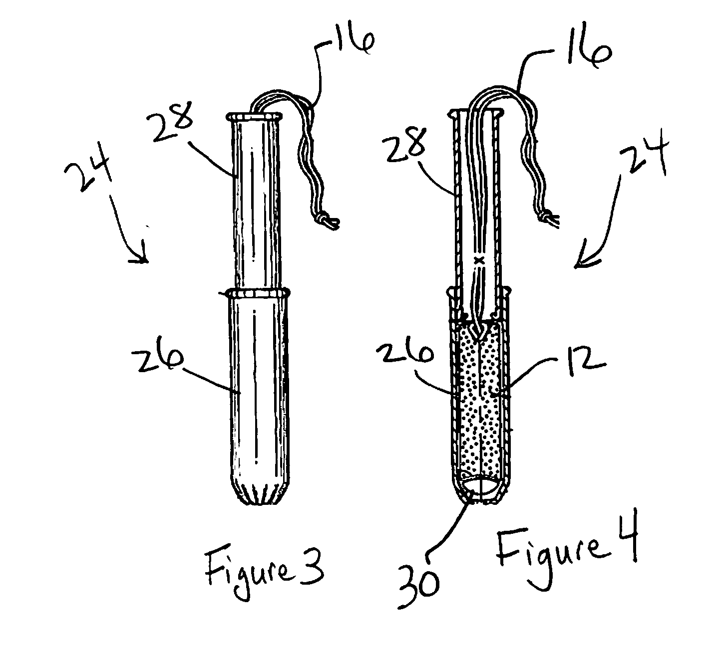 Apparatus and method for the treatment of abnormal uterine bleeding