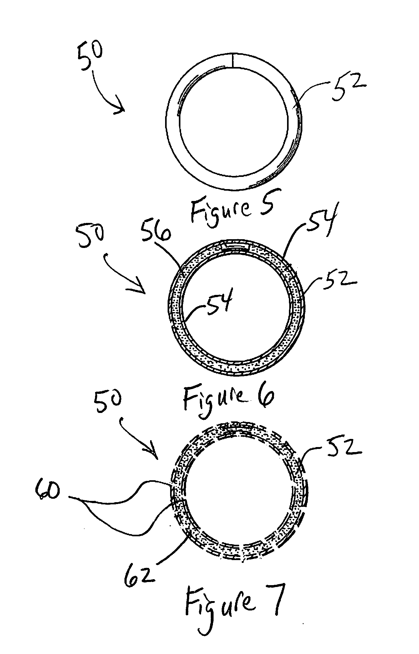 Apparatus and method for the treatment of abnormal uterine bleeding