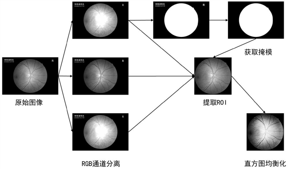 Eye fundus photo classification method and eye fundus image processing method and system