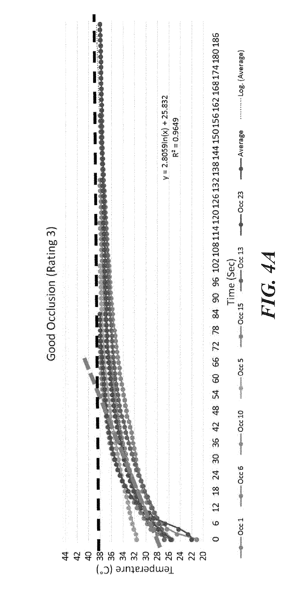 Determination of pulmonary vein and other vascular occlusion using temperature profile following cold saline injection