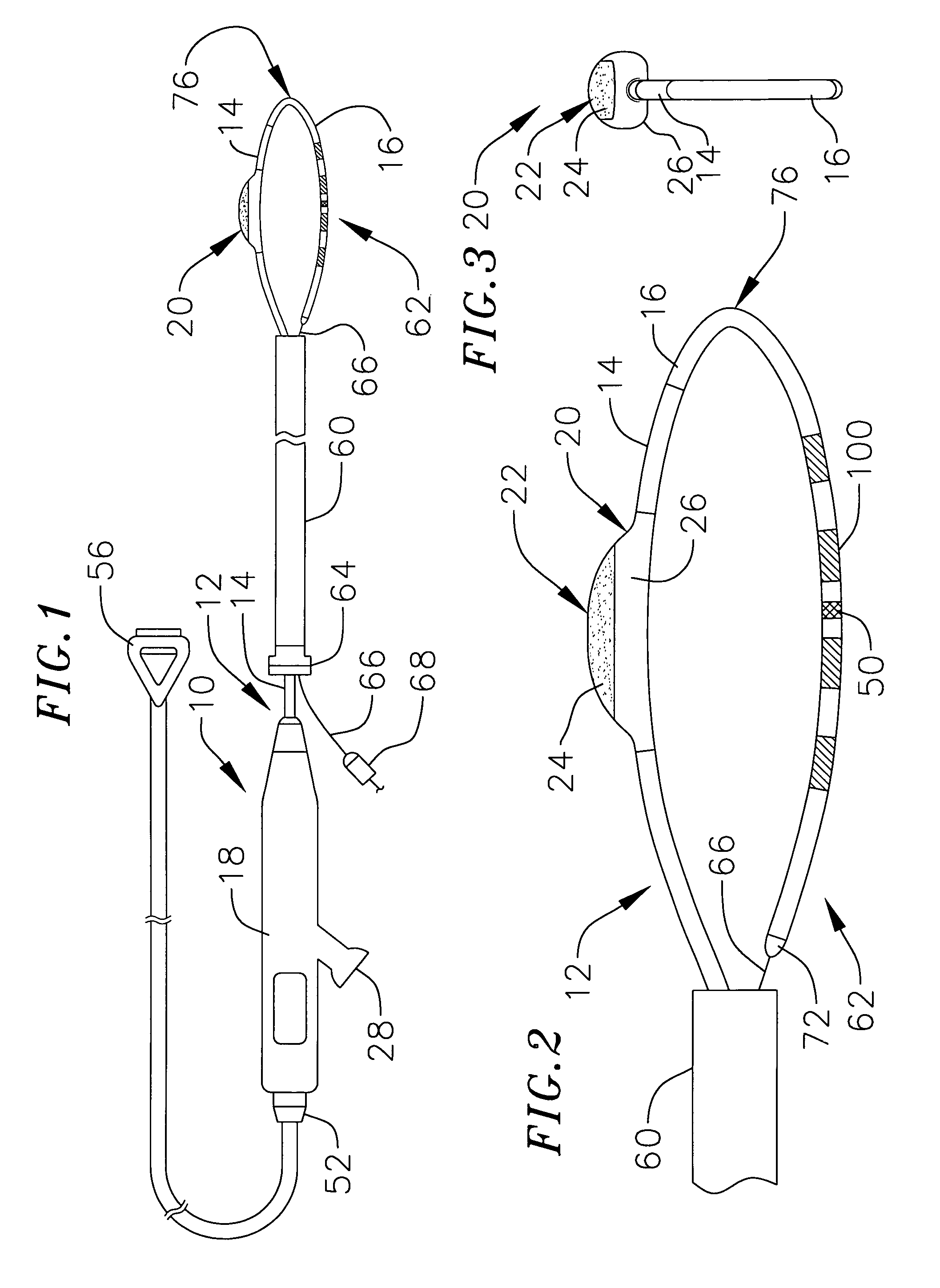 Loop structure including inflatable therapeutic device