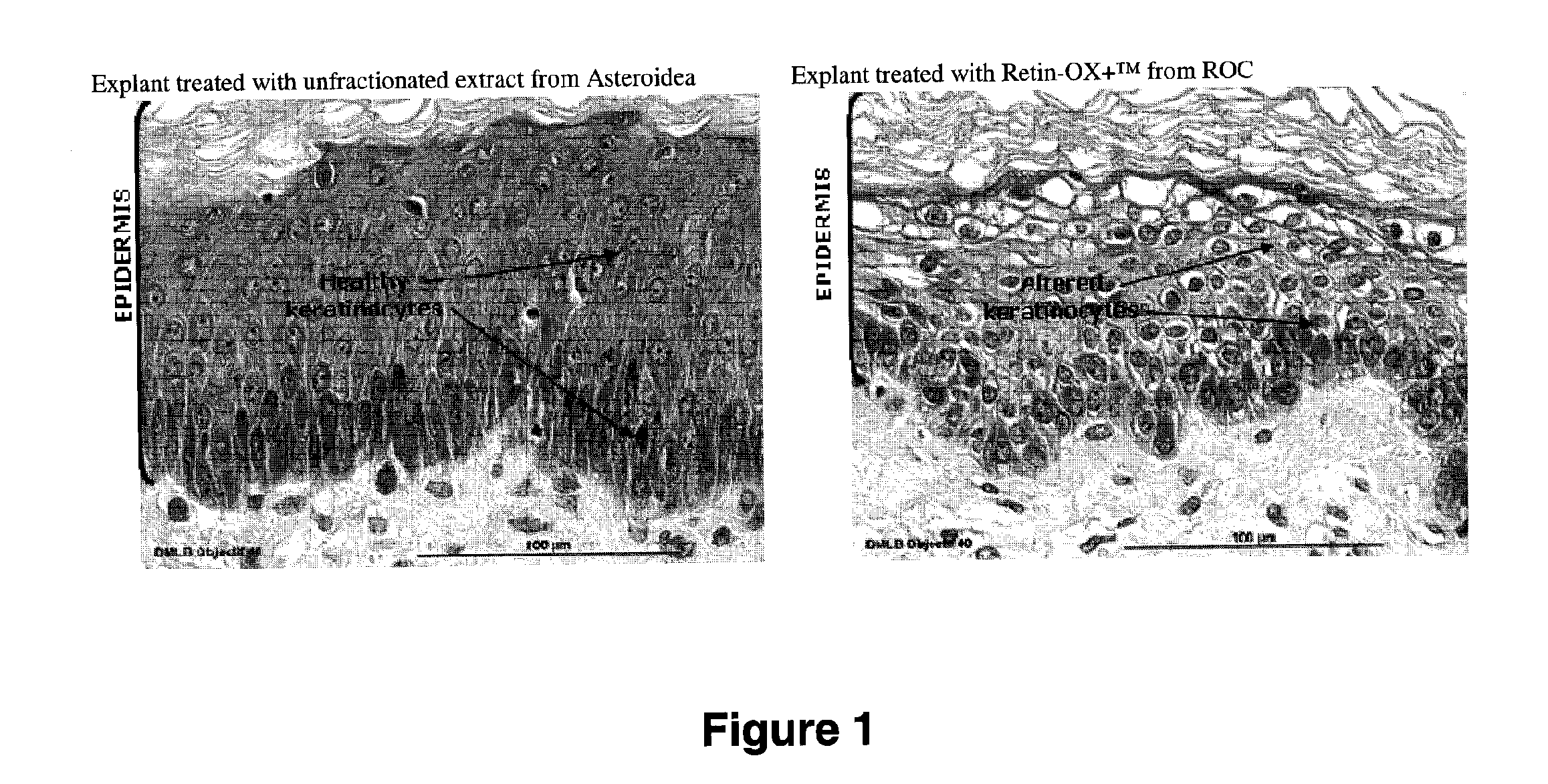 Cosmetic compositions comprising asteroidea body fluid and methods of use thereof