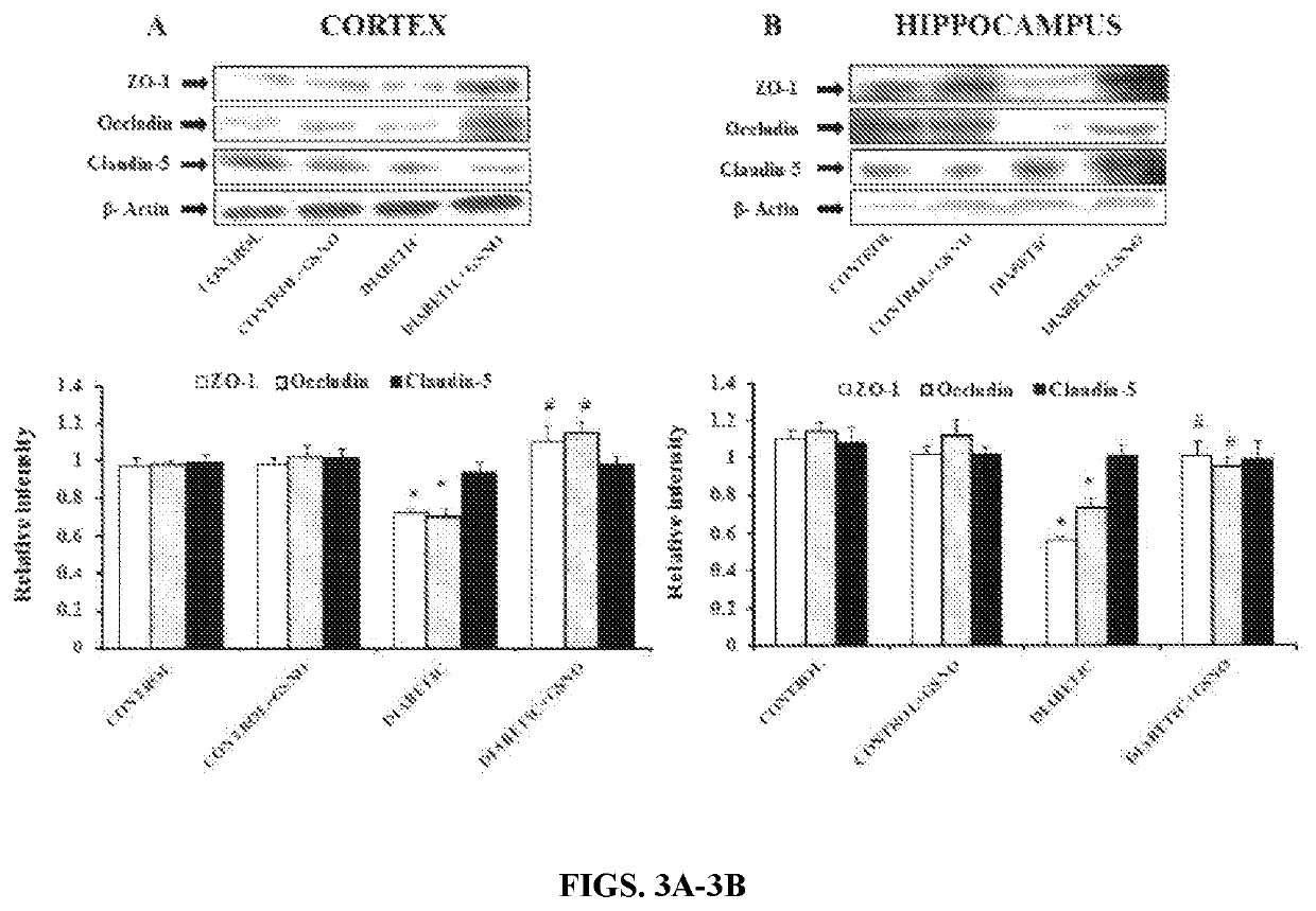 S-nitrosoglutathione (GSNO) and GSNO reductase inhibitors for use in therapy