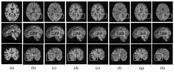 Brain magnetic resonance image segmentation method based on scattering graph neural network