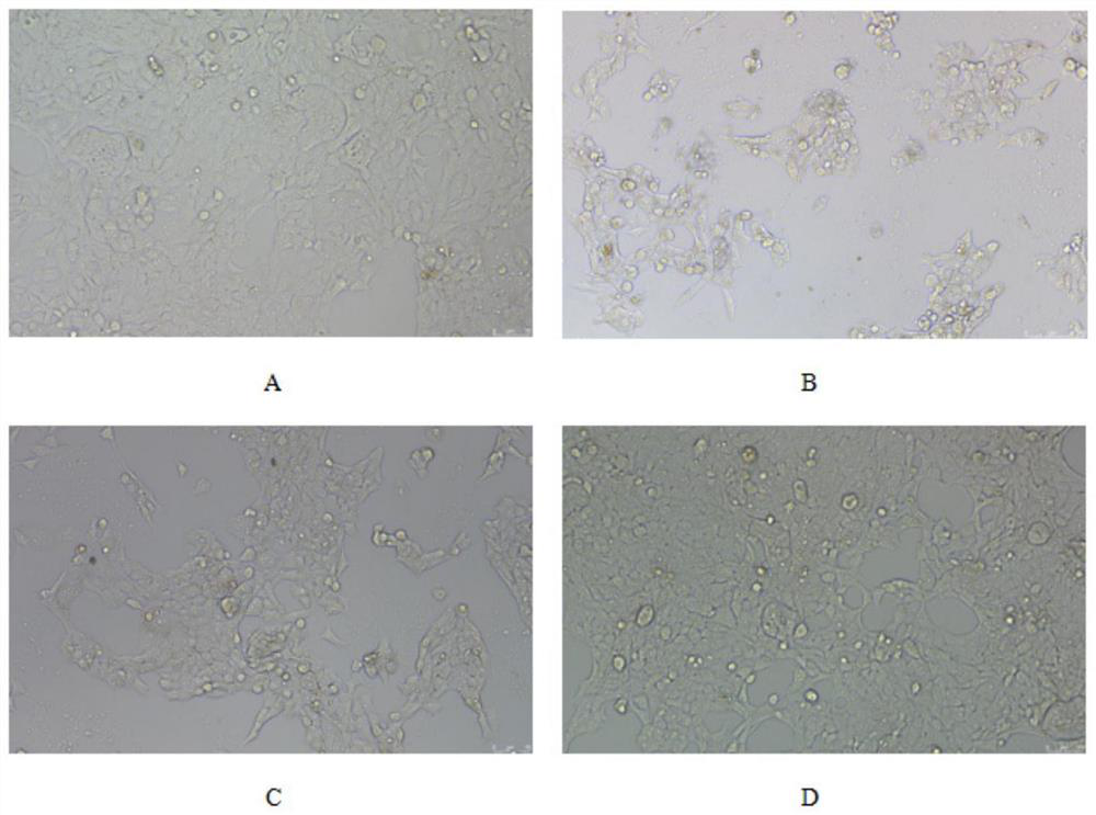 Application of ailanthus altissima milk gel in preparation of drugs for resisting low-risk HPV infection and preventing and treating low-risk HPV related diseases