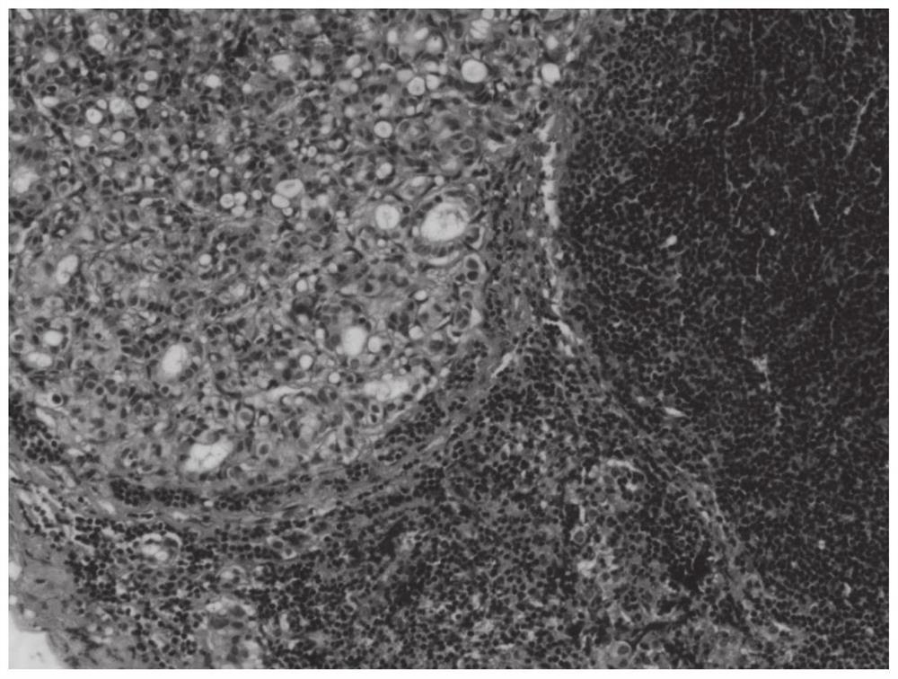 Breast cancer sentinel lymph node metastasis in-vivo fluorescence targeting tracer agent and preparation method thereof