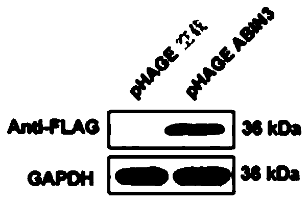 Application of nuclear factor kappa b inhibitory protein 3 combined with a20 in the preparation of drugs for treating fatty liver and related diseases