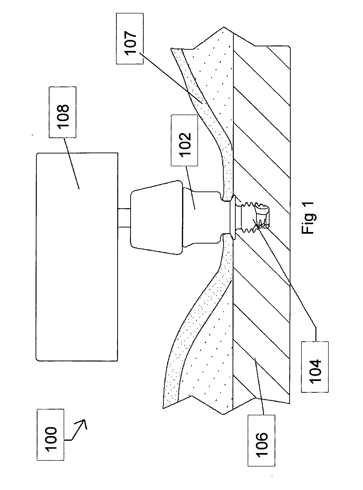 Hearing-aid anchoring element