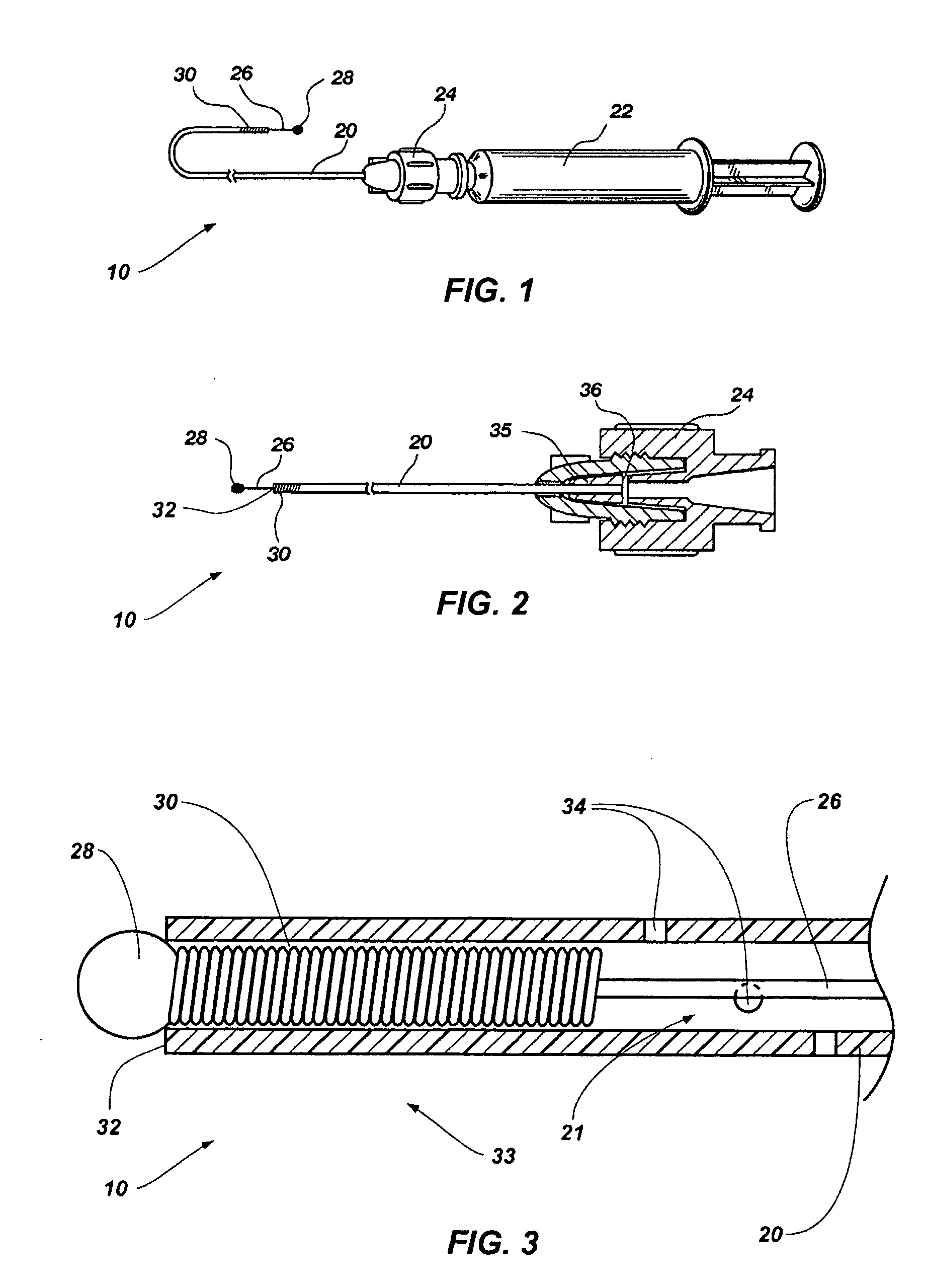 Ultrasound guided echogenic catheter and related methods