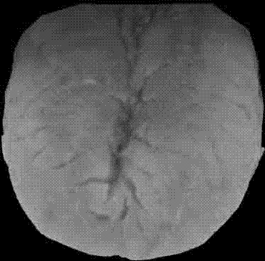 Method for recognizing fissured tongue based on support vector machine