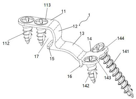 Fusion door opening fixing device and spinal internal fixing system