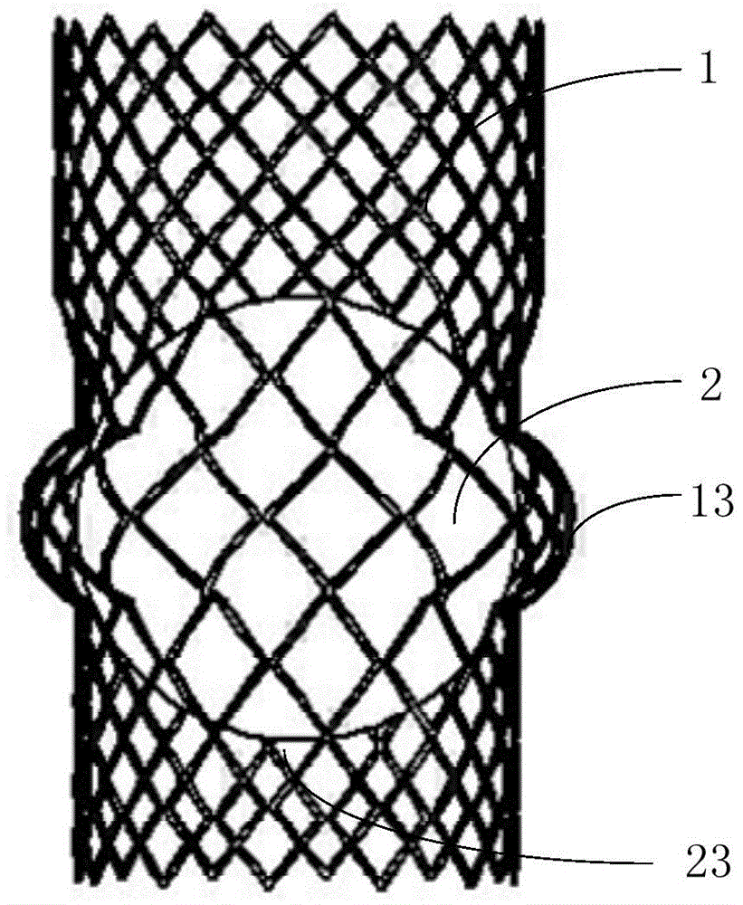 A liquid-filled cage ball type aortic valve stent system