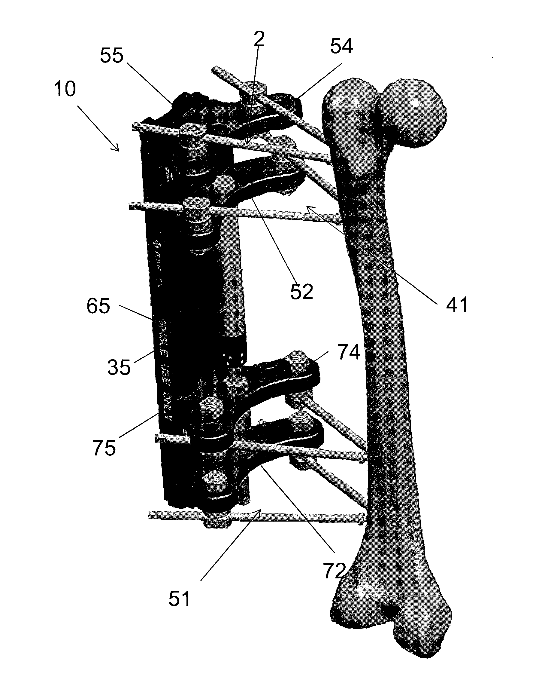 Elongated pin for an external modular fixation system for temporary and/or permanent fixation applications and external modular fixation system