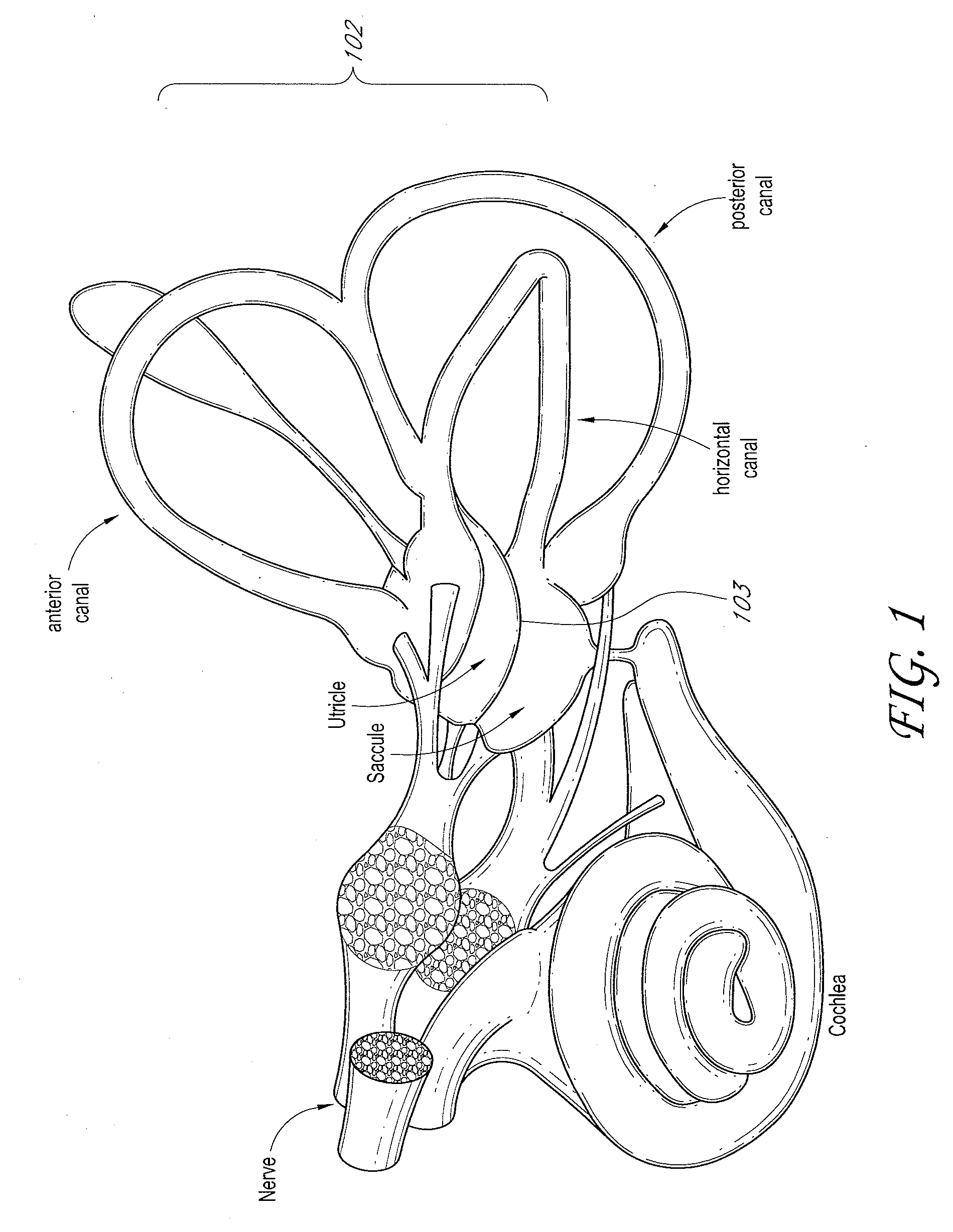 Auricular thermoregulation system for appetite suppression