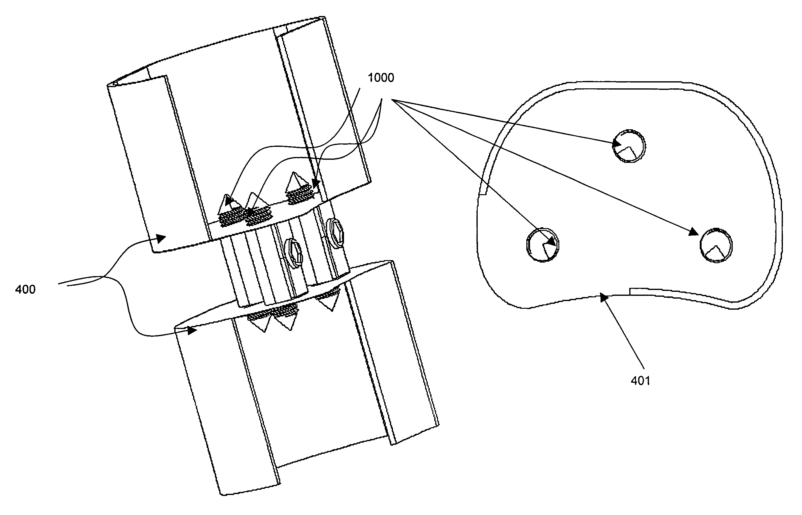 Bi-directional fixating transvertebral body screws, zero-profile horizontal intervertebral miniplates, expansile intervertebral body fusion devices, and posterior motion-calibrating interarticulating joint stapling device for spinal fusion