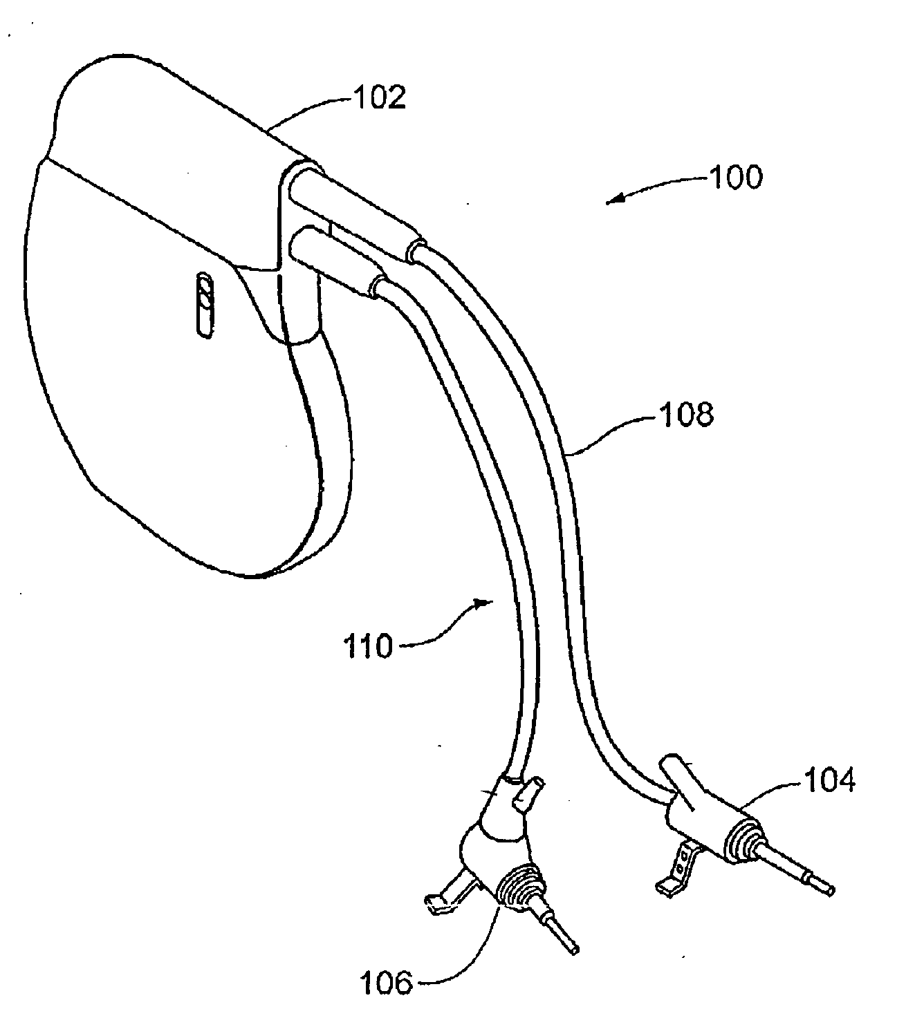 Method and apparatus for vibrational damping of implantable hearing aid components