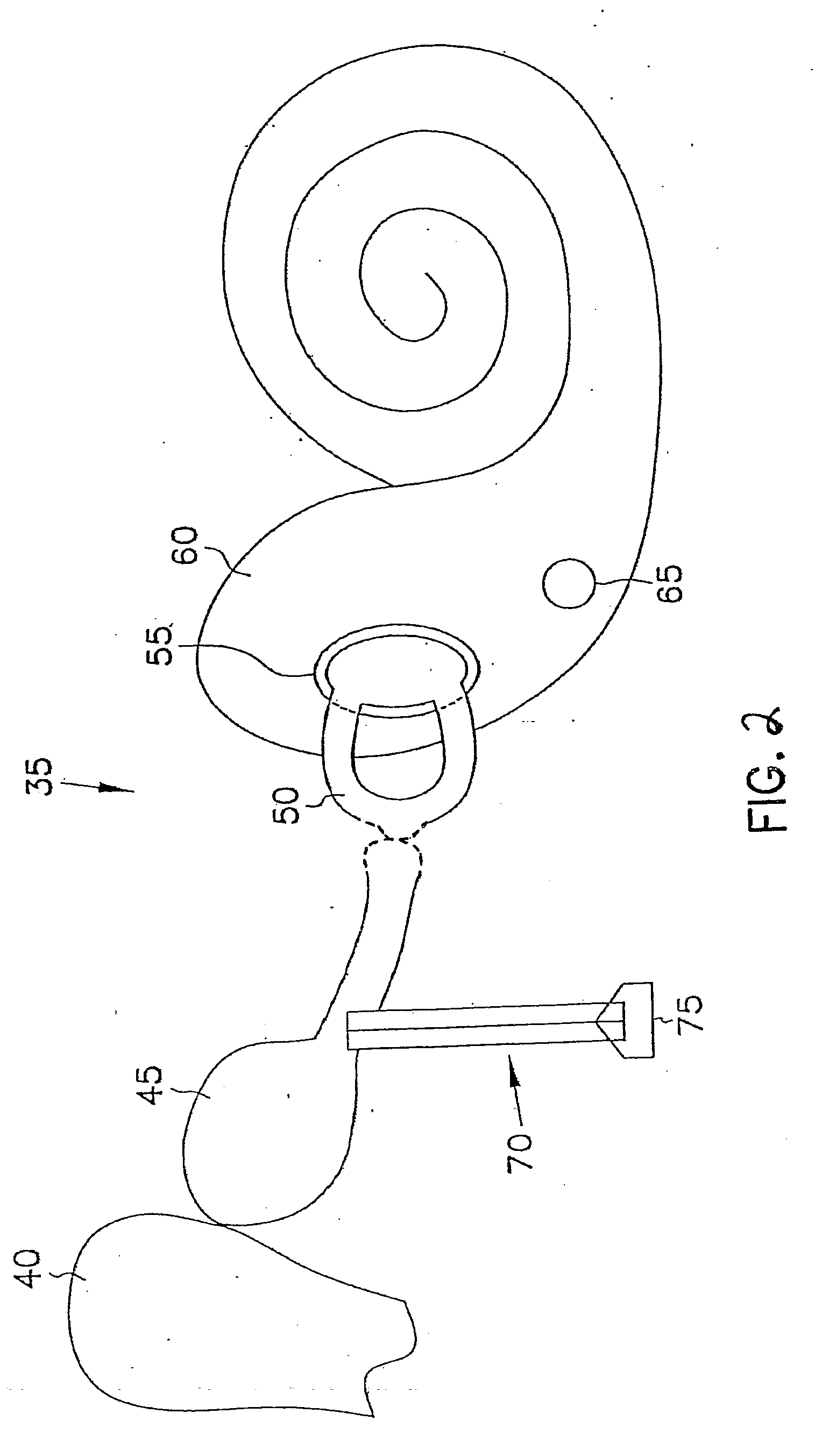 Method and apparatus for vibrational damping of implantable hearing aid components