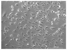 A kind of mesenchymal stem cell membrane camouflage magnetic drug-loaded nanoparticle and its preparation method and application