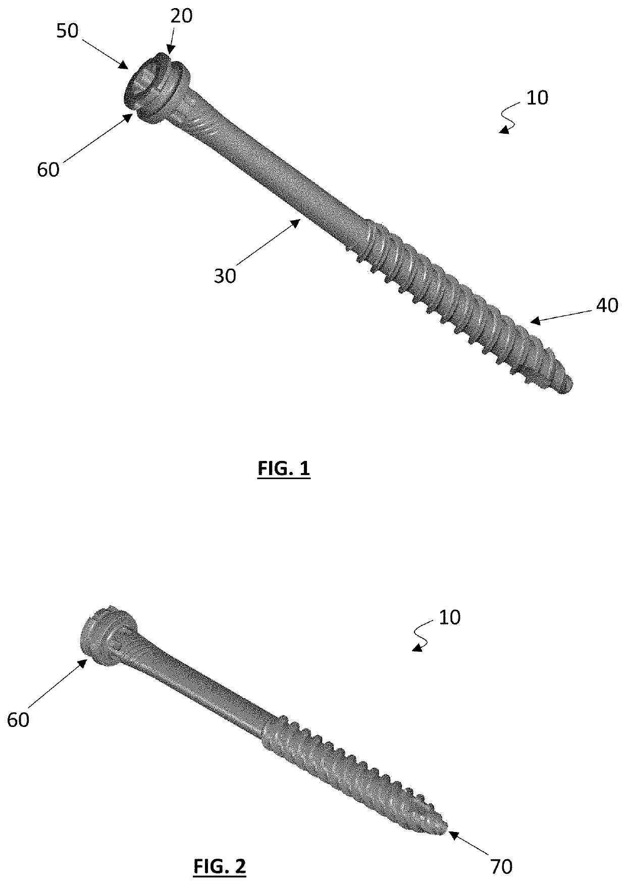 Backout Resistant Screw