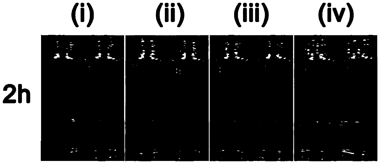 Preparation method of chitosan-metal organic framework antibacterial material