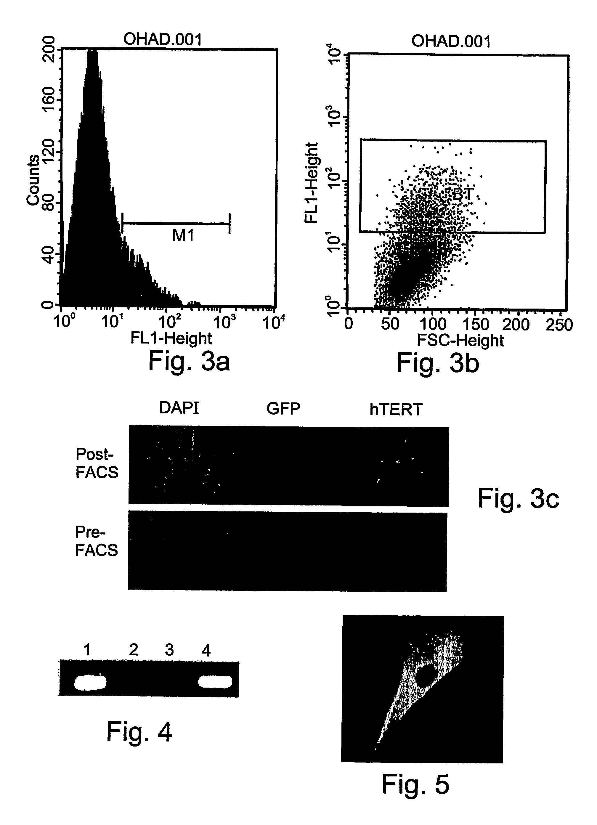 Insulin-producing bone marrow derived cells and methods of generating and using same
