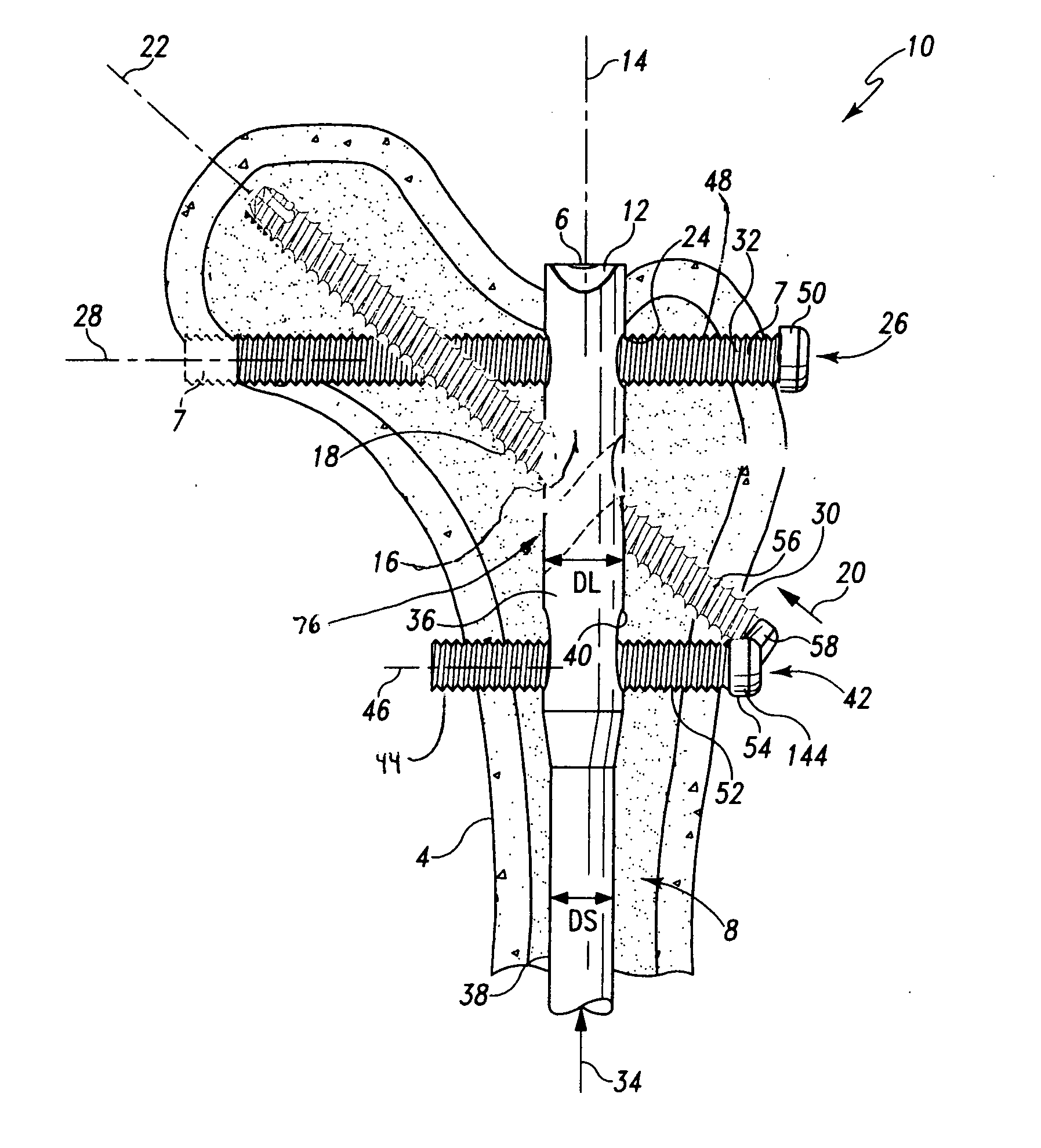 Multiple purpose nail, nail assembly and associated method