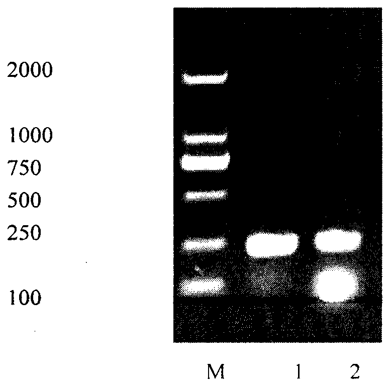 Toxoplasma circulating antigen double antibody sandwich ELISA (Enzyme-Linked Immuno Sorbent Assay) detection method