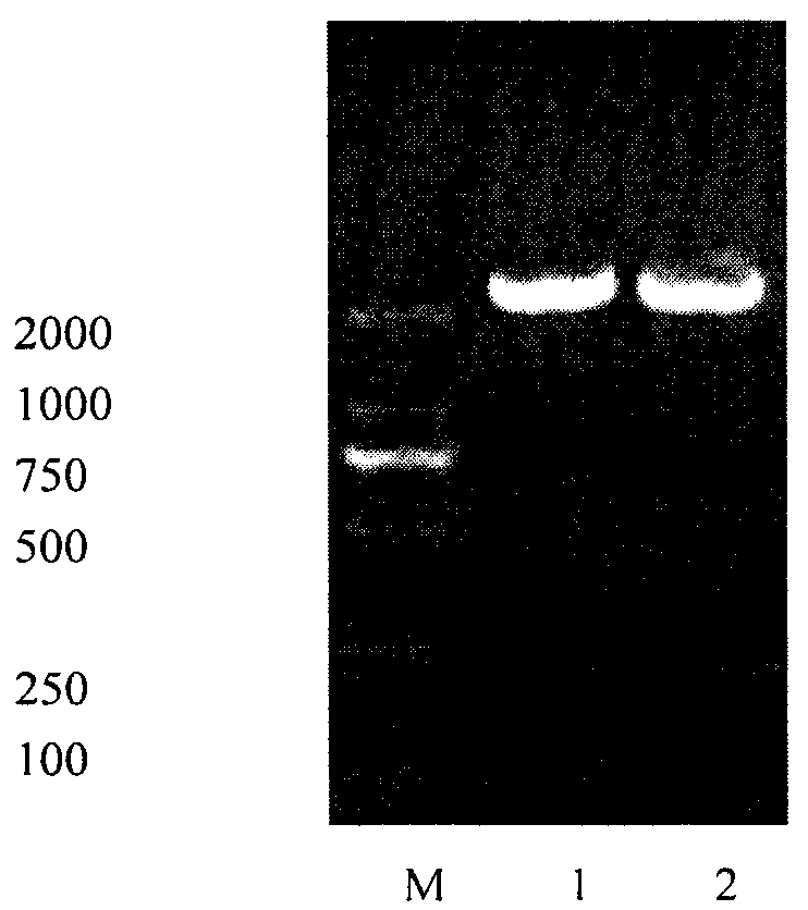Toxoplasma circulating antigen double antibody sandwich ELISA (Enzyme-Linked Immuno Sorbent Assay) detection method