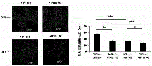 Application of dcf1 gene to regulation and control over expression of ATP1B1