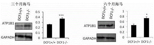 Application of dcf1 gene to regulation and control over expression of ATP1B1