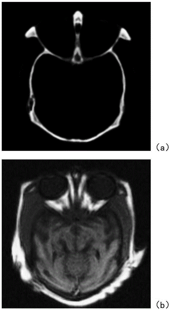 Medical image fusion method based on WEMD and PCNN