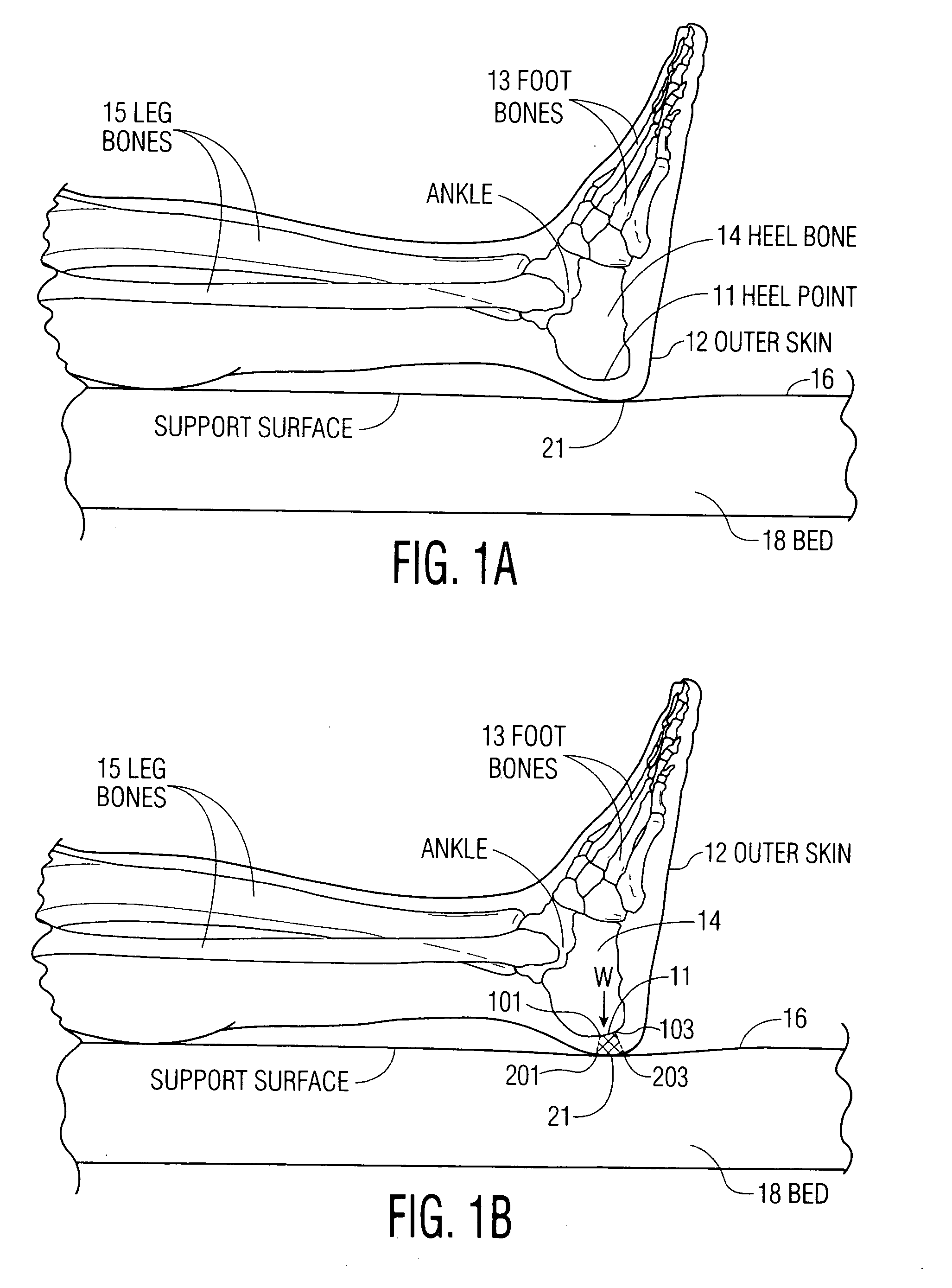 Apparatus and methods for preventing and/or healing pressure ulcers