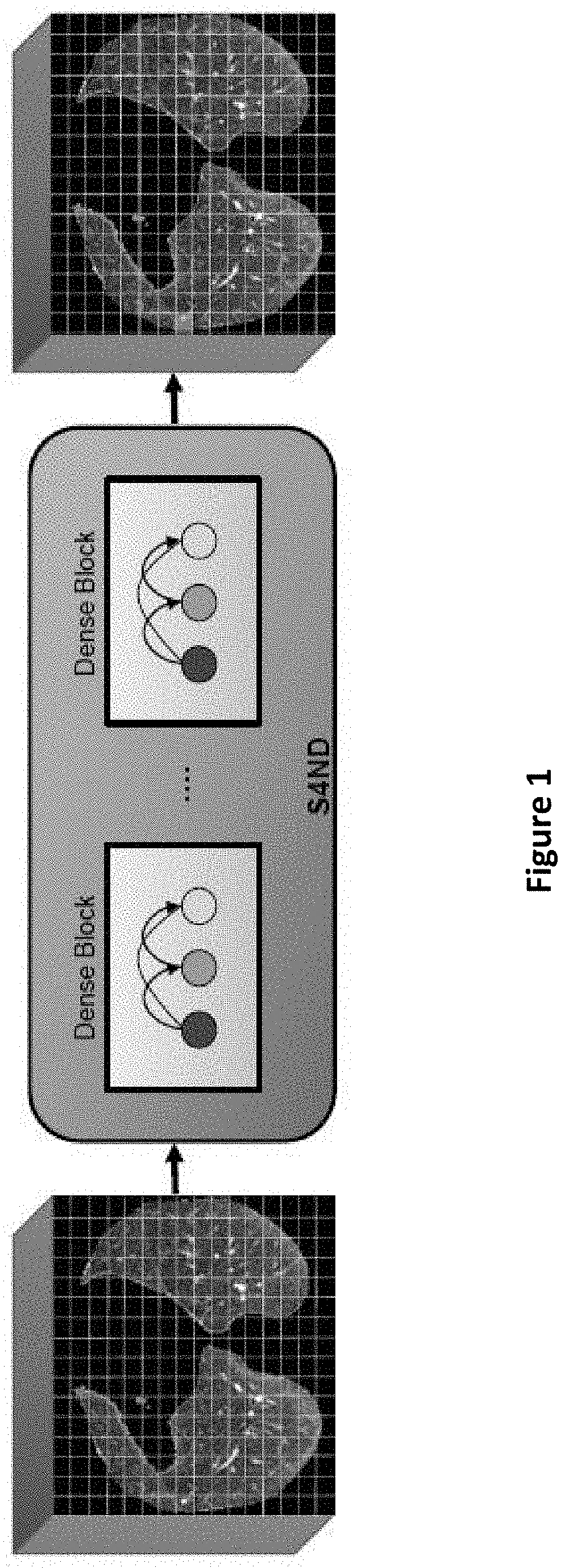 Method for detection and diagnosis of lung and pancreatic cancers from imaging scans