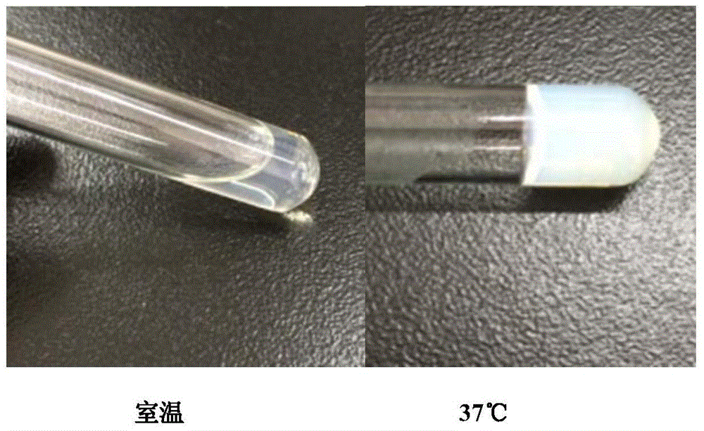 Temperature-sensitive gel containing ropivacaine and used for long-acting injection and preparation method of temperature-sensitive gel