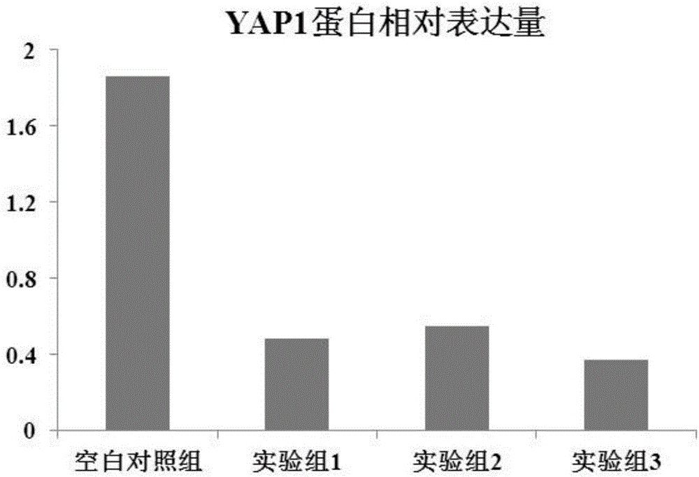 YAP1 gene and application of inhibitor in enhancing chemosensitivity of stem cell of bladder cancer