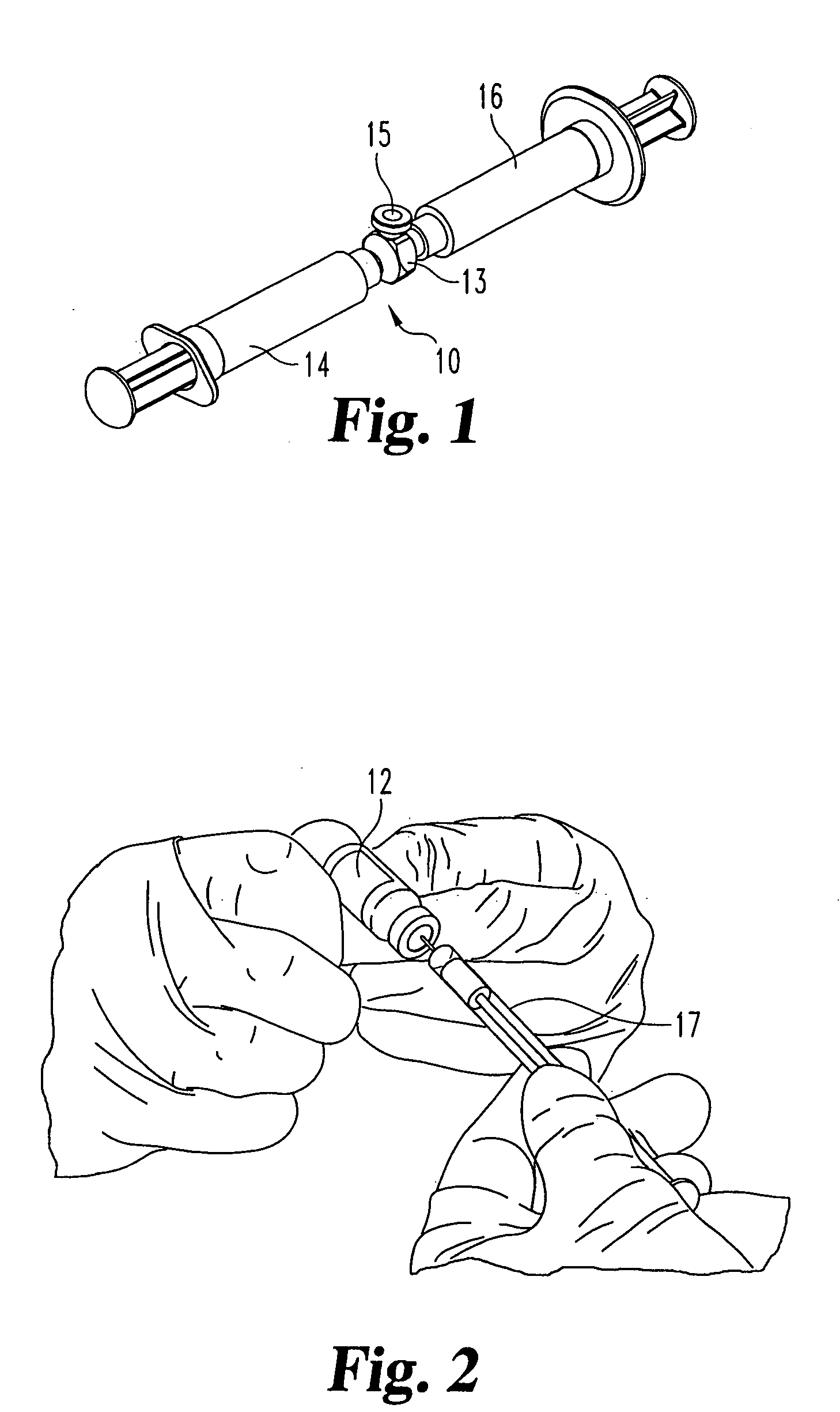 Apparatus and kit for injecting a curable biomaterial into into an intervertebral space
