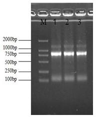Cloning Method of Cytochrome Oxidase Gene of Peri. didentatus