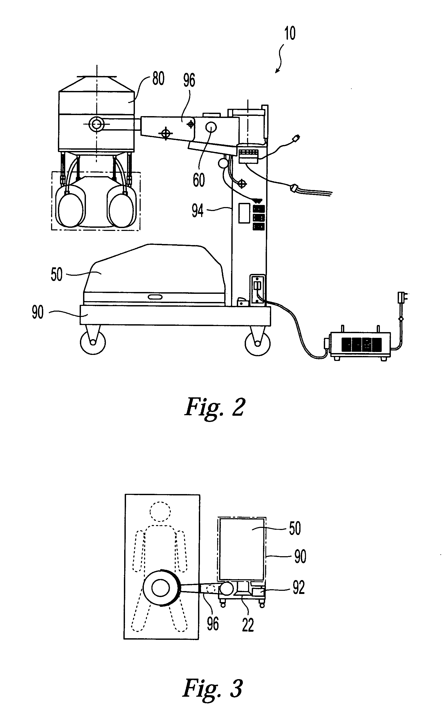 External counter pulsation apparatus