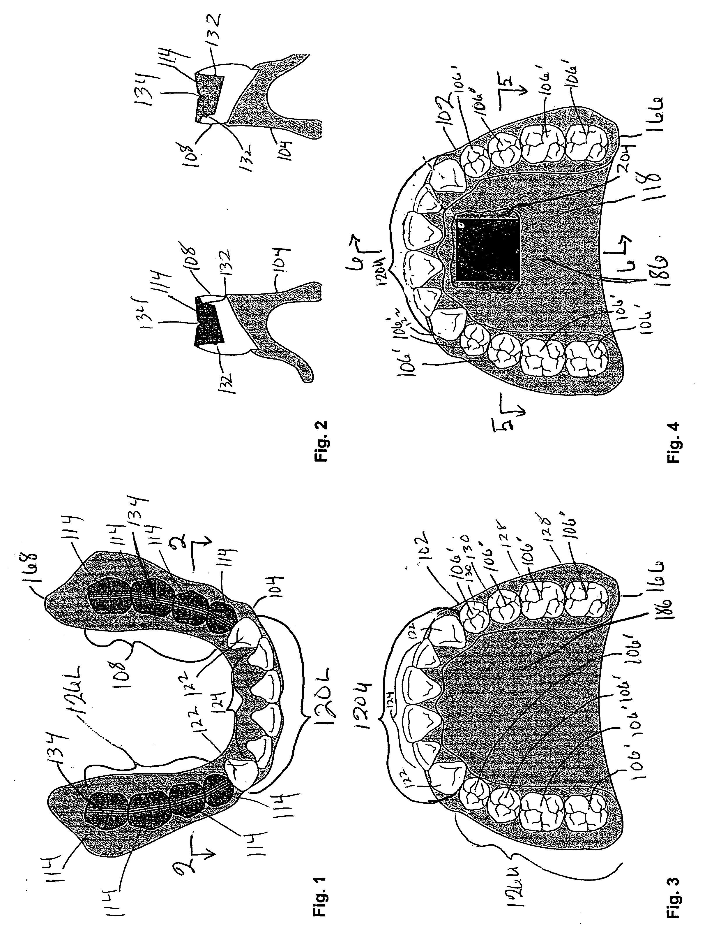 Method for developing balanced occlusion in dentistry