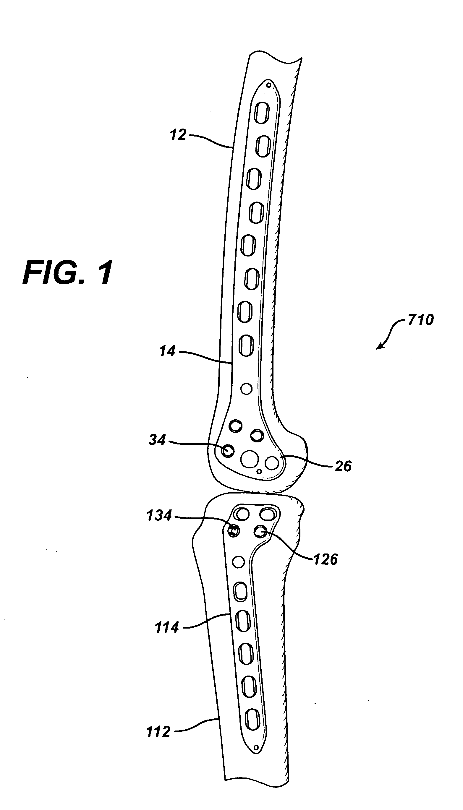 Dual locking plate and associated method