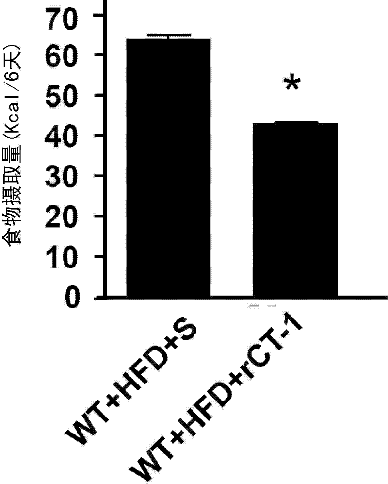 Use of cardiotrophin- 1 for the treatment of metabolic diseases