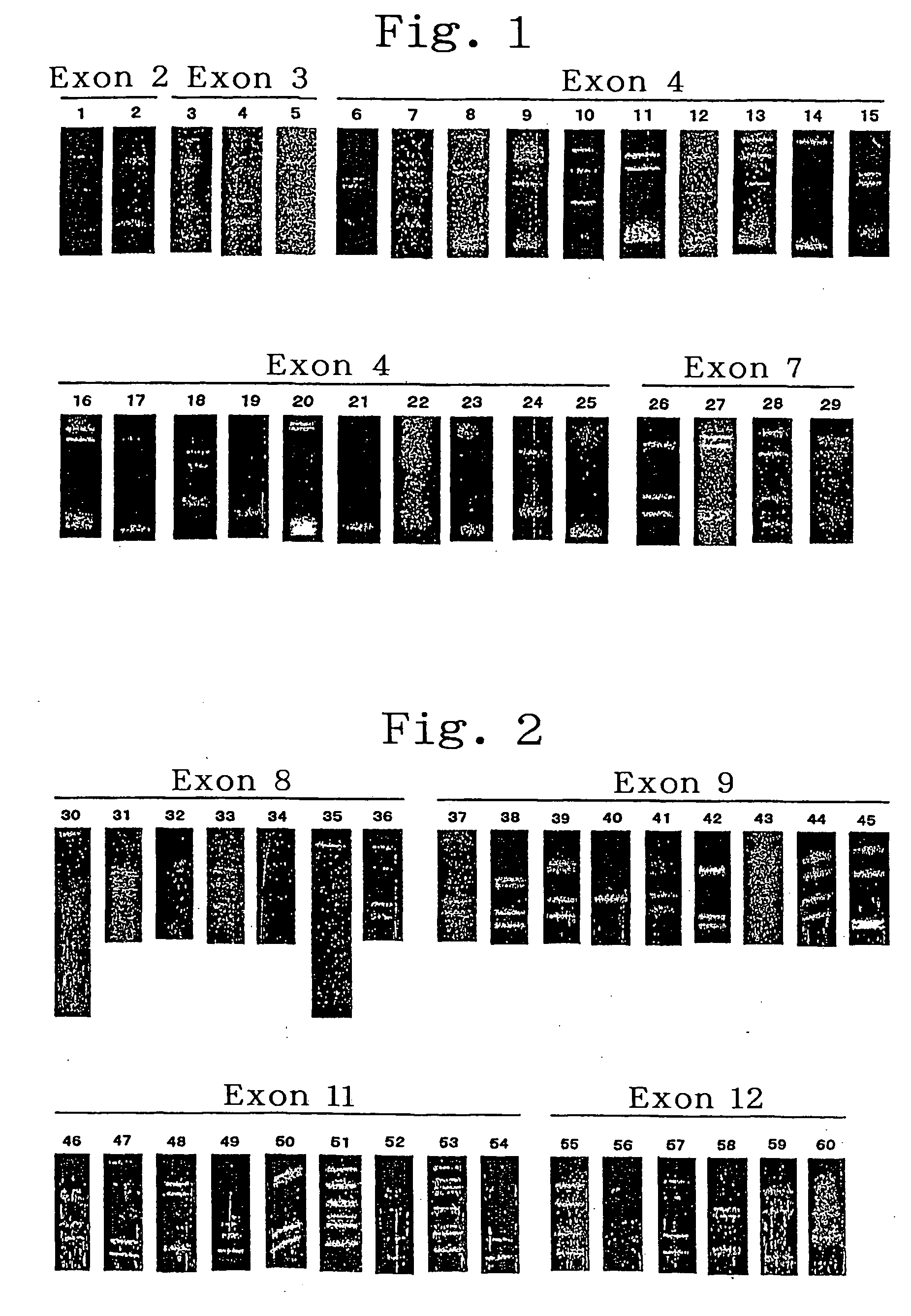 Method of detecting lipid metabolic errors