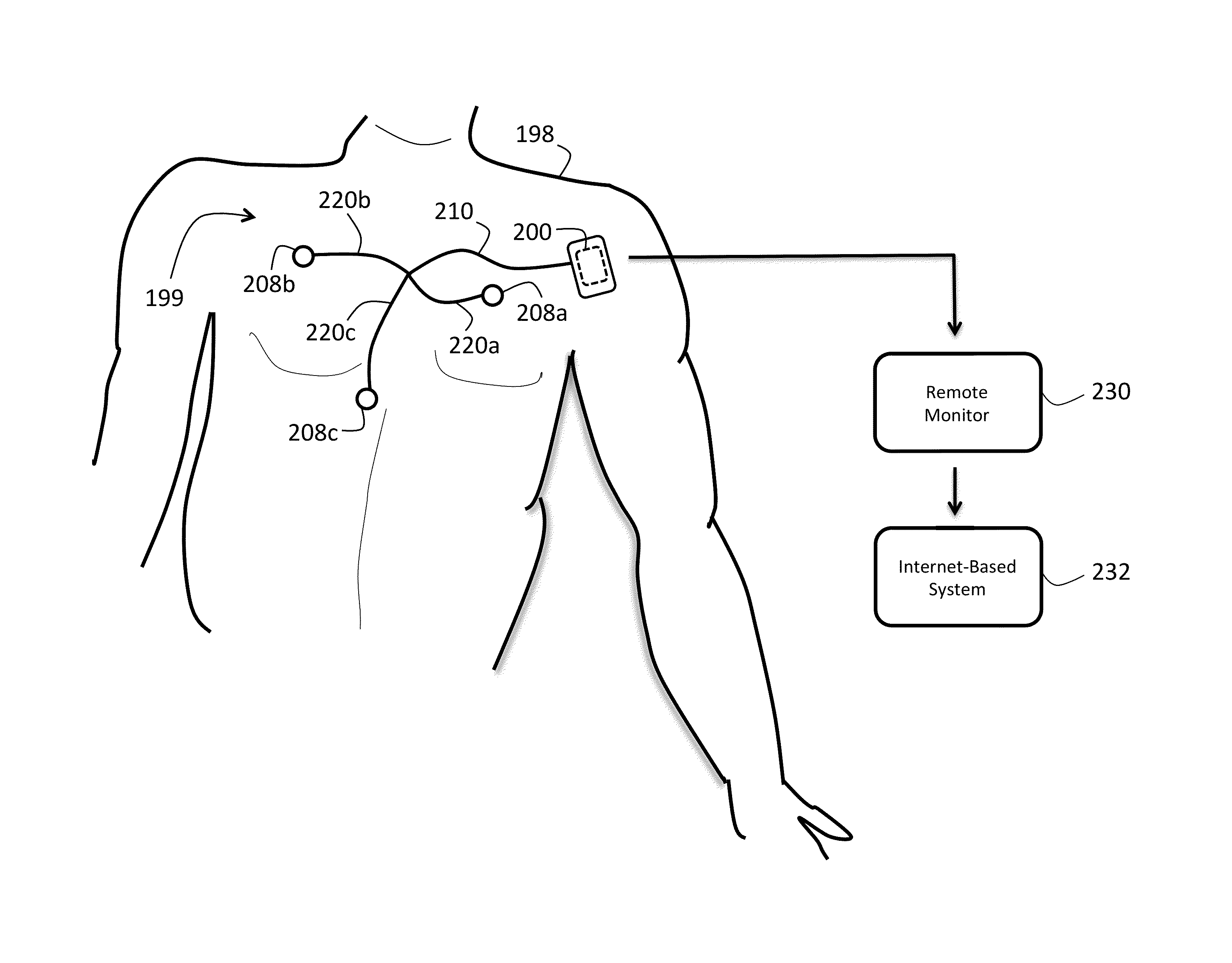 Database and algorithm for evaluating efficacy of an electrophysiology procedure