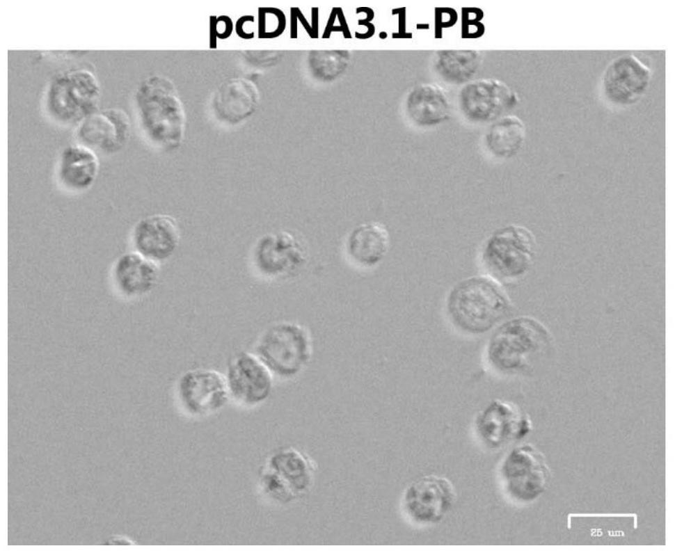 A transposase that efficiently mediates the integration of foreign genes and its use